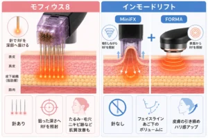Two-panel infographic comparing RF skin treatments: left shows needles delivering energy into skin layers (epidermis to fat) for tightening; right shows noninvasive RF lift with two devices (MinFX and Forma) heating beneath the skin surface for a lift.