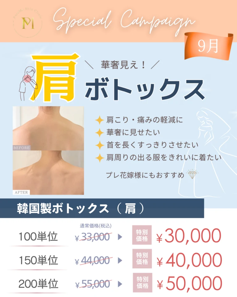 ボトックス