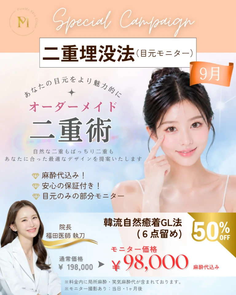 二重埋没法（GL法6点留め）