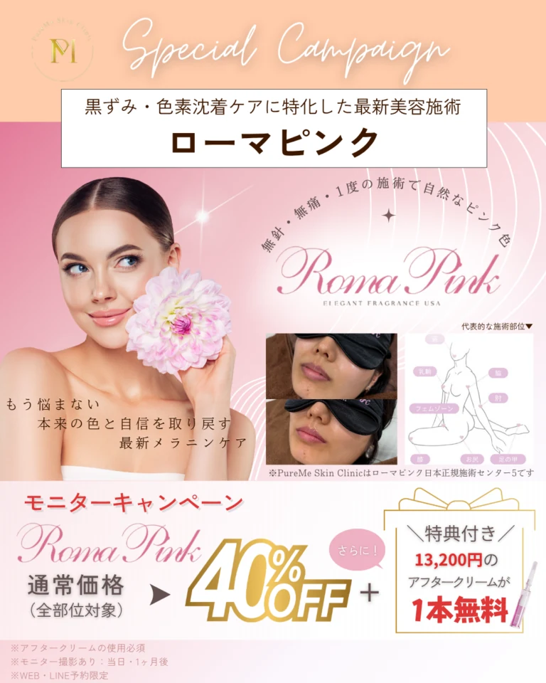 ローマピンク（RomaPink)