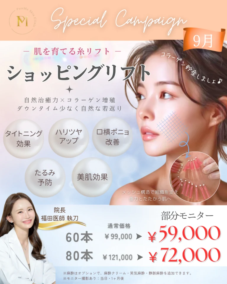 ショッピングリフト